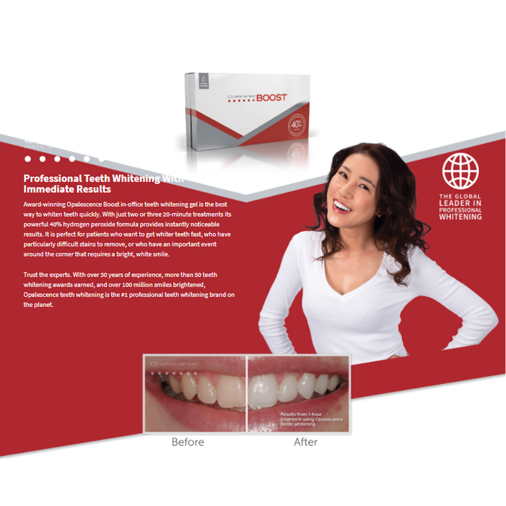 Opalescence Boost 40% PF Ameri - огляд і ціна Teeth Whitening Opalescence