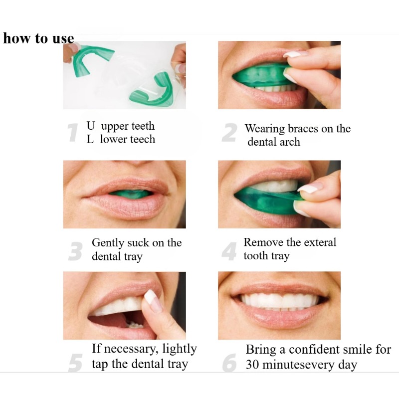 Set Teeth Whitening Tray U-sha - огляд і ціна Teeth Whitening Opalescence