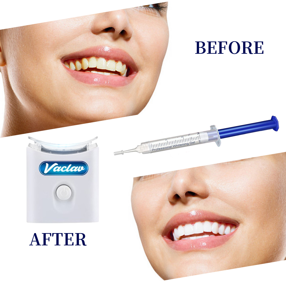 Mint Teeth Whitening Gel Syrin - огляд і ціна Teeth Whitening Opalescence
