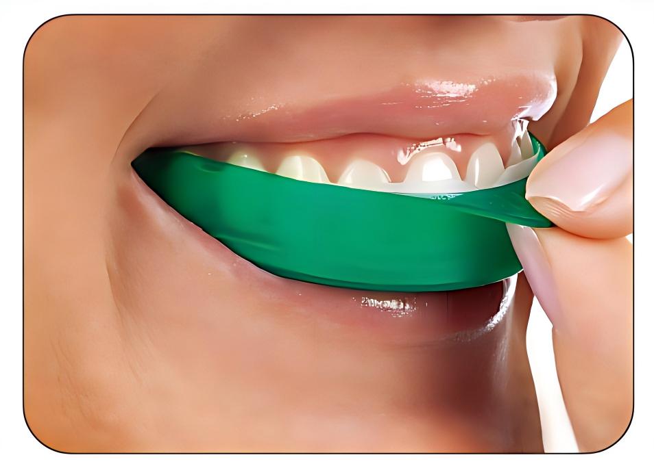 Ultradent Opalescence Go Teeth - огляд і ціна Teeth Whitening Opalescence Go