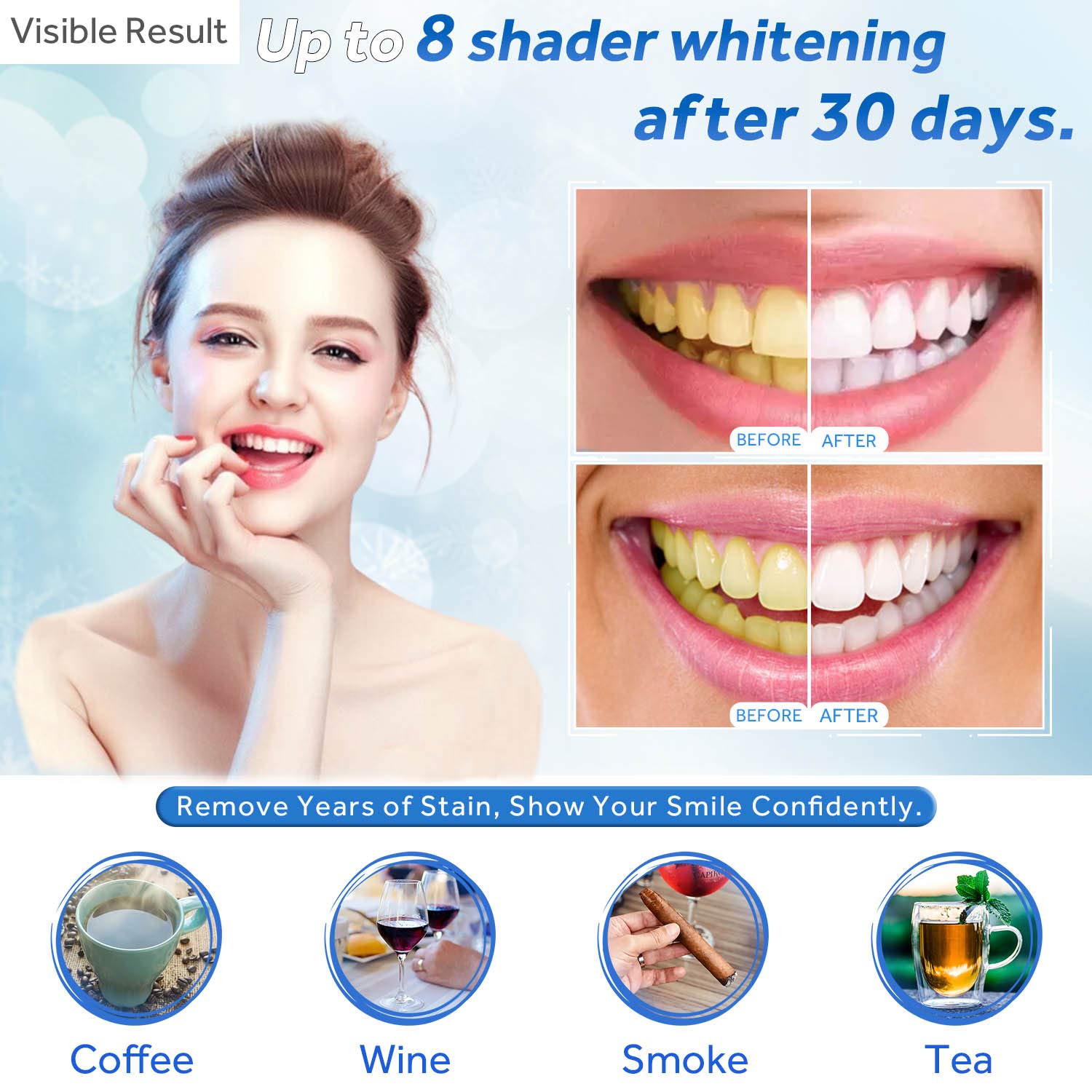 Teeth Whitening Gel Refill Syr - огляд і ціна Teeth Whitening (Bleaching)
