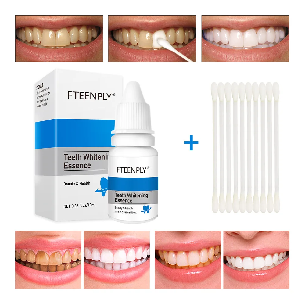 FTEENPLY Teeth Whitening Essen - огляд і ціна Teeth Whitening (Bleaching)