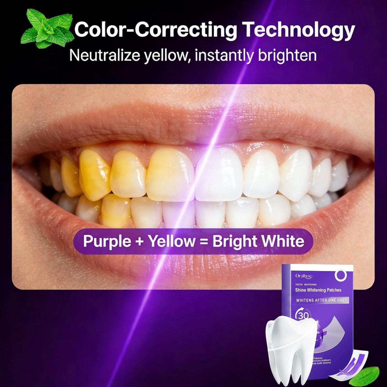 Purple Teeth Whitening Combo K - огляд і ціна Teeth Whitening Home Kit