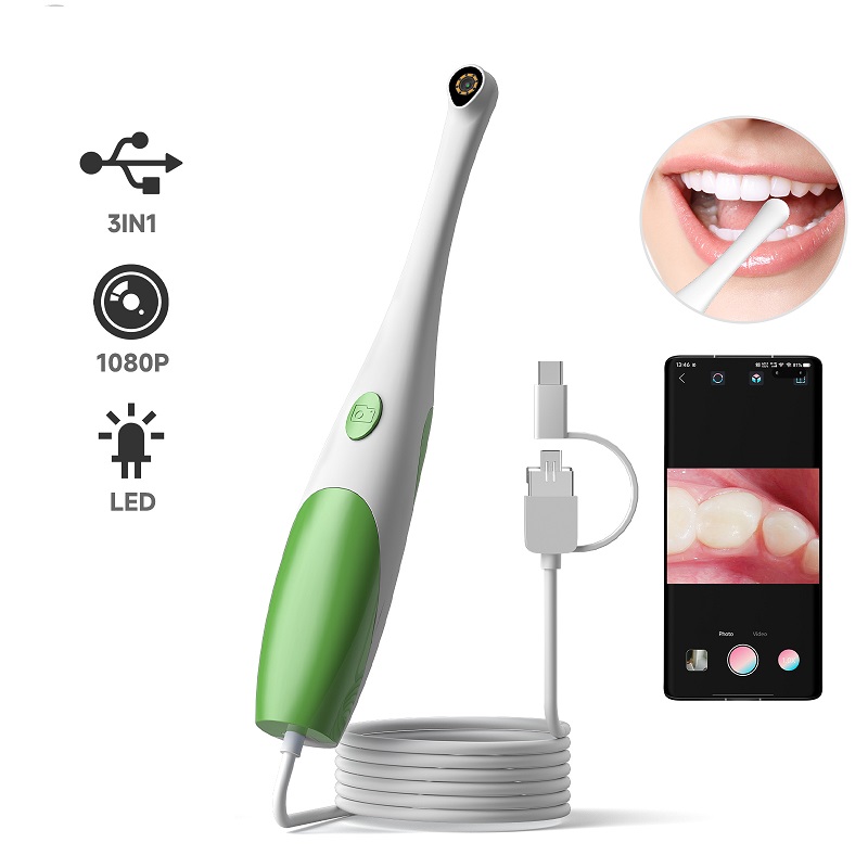 TYPE-C Visual Oral Camera 3in1 - огляд і ціна Teeth Whitening Video
