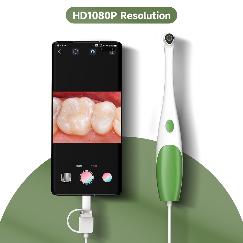 TYPE-C Oral Endoscope Handheld - огляд і ціна Teeth Whitening Video