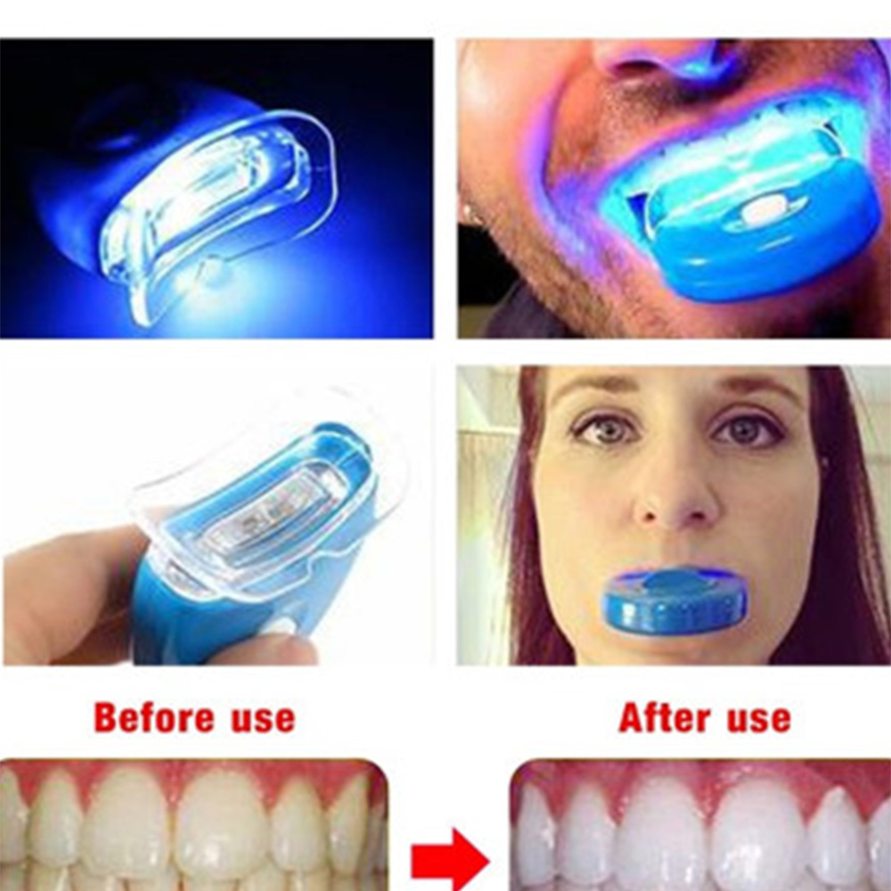 New Blue Led Teeth Whitening A - огляд і ціна Teeth Whitening Video