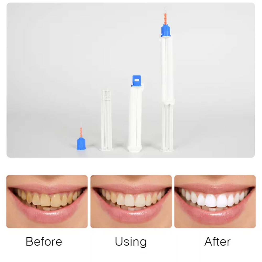 10 /5/2pcs Dental Dual Barrel  - огляд і ціна Teeth Whitening Opalescence