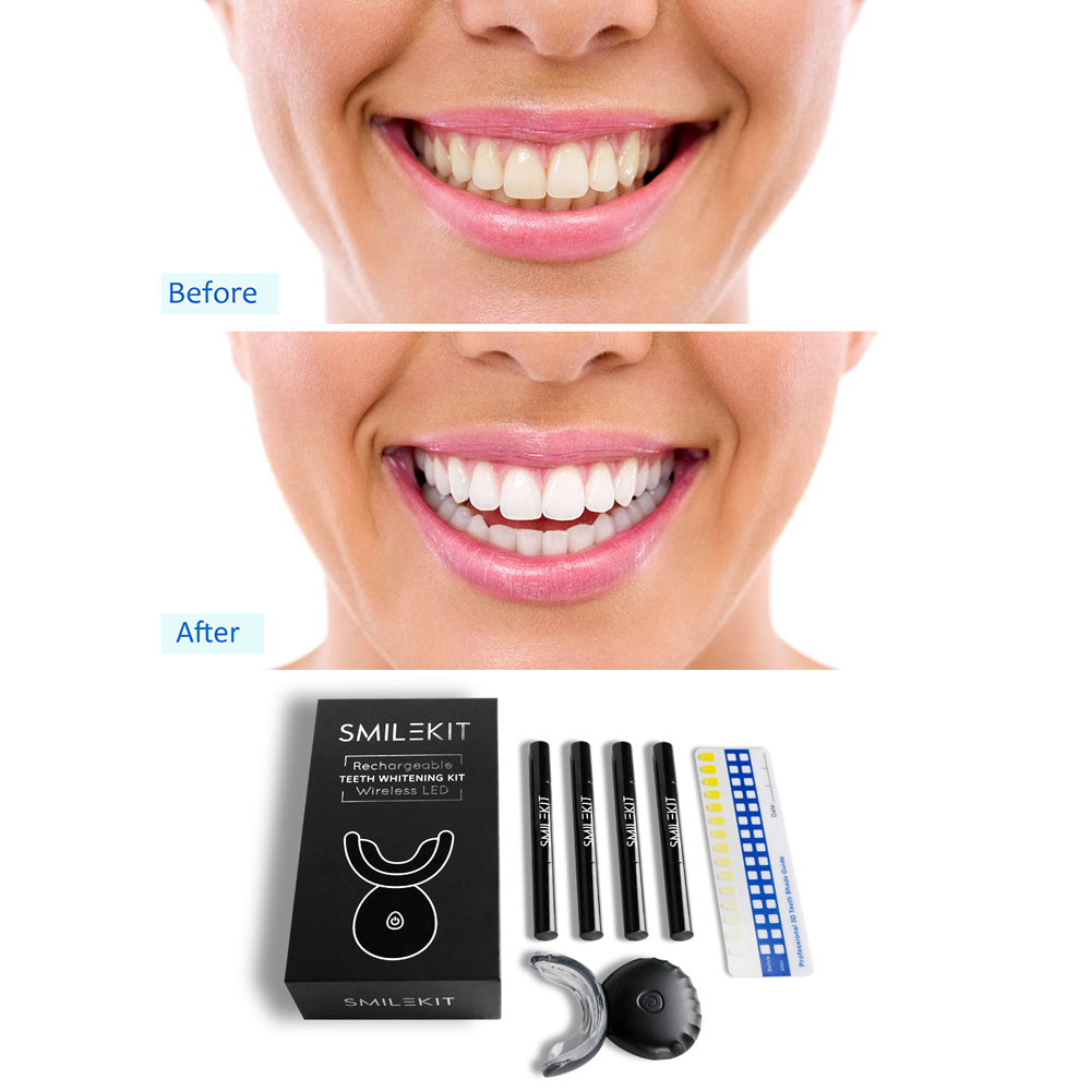 New Electric Teeth Whitening L - огляд і ціна Teeth Whitening Home Kit