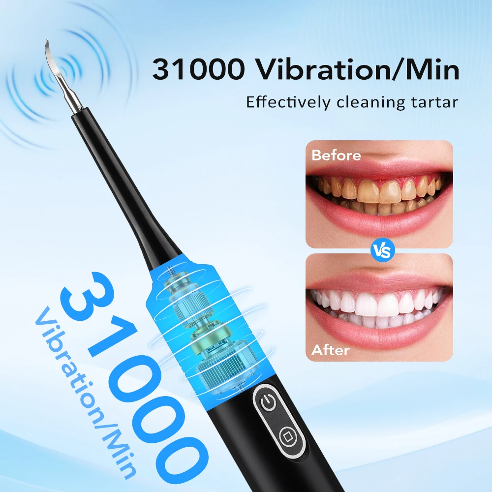 Electric Sonic Vibration Denta - огляд і ціна Teeth Whitening Mouthwash